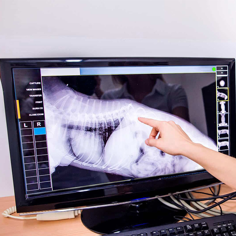 a-hand-pointing-at-an-x-ray-on-a-computer-screen